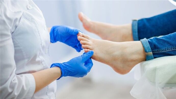 sintomi del fungo del piede