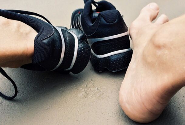 Le cause dell'apparizione della micosi delle gambe
