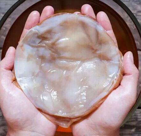 fungo delle unghie kombucha